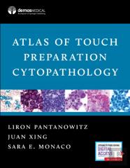 Atlas Of Touch Preparation Cytopathology
