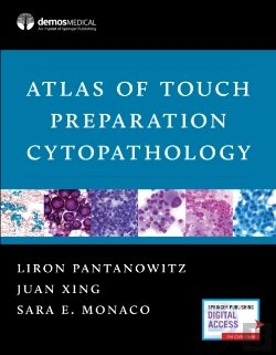 Bertrand.pt - Atlas Of Touch Preparation Cytopathology