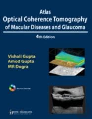 Atlas Optical Coherence Tomography Of Macular Diseases And Glaucoma