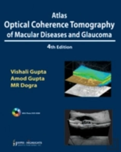 Bertrand.pt - Atlas Optical Coherence Tomography Of Macular Diseases And Glaucoma