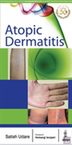 Bertrand.pt - Atopic Dermatitis