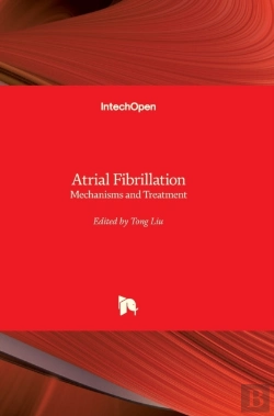 Bertrand.pt - Atrial Fibrillation