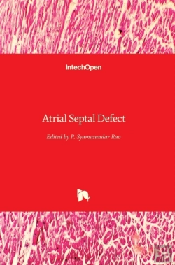 Bertrand.pt - Atrial Septal Defect