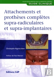 Attachement Et Prothese Complete Supraradiculaire Et Supra Implantaire
