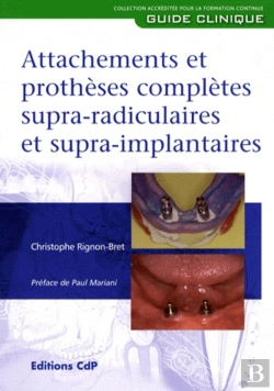 Bertrand.pt - Attachement Et Prothese Complete Supraradiculaire Et Supra Implantaire