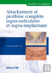 Attachements Et Prothèse Complète Supra-Radiculaire Et Supra-Implantaire