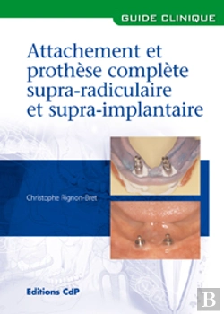 Bertrand.pt - Attachements Et Prothèse Complète Supra-Radiculaire Et Supra-Implantaire