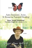 Auto-Immune, Acne, & Rosacea Natural Healing - How 'Smart Emotions' Precisely Target Life'S Issues & Why
