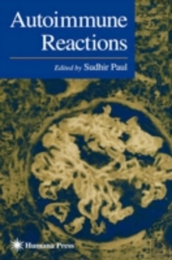 Bertrand.pt - Autoimmune Reactions