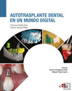 Bertrand.pt - Autotrasplante Dental En Un Mundo Digital