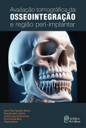 Avaliação Tomográfica Da Osseointegração E Região Peri-Implantar