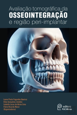 Bertrand.pt - Avaliação Tomográfica Da Osseointegração E Região Peri-Implantar