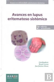 Avances En Lupus Eritematoso Sistémico