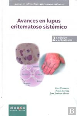 Bertrand.pt - Avances En Lupus Eritematoso Sistémico