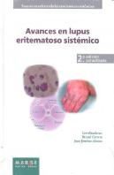 Avances En Lupus Eritematoso Sistémico