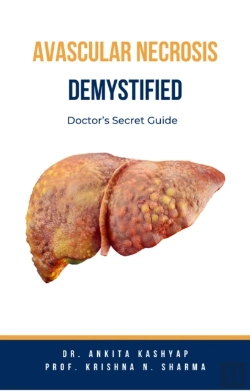 Bertrand.pt - Avascular Necrosis Demystified: Doctor'S Secret Guide