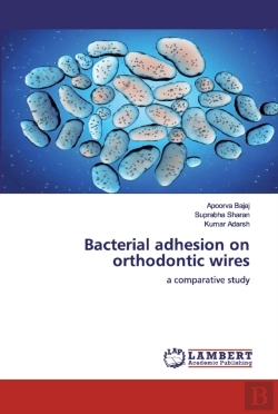 Bertrand.pt - Bacterial Adhesion On Orthodontic Wires