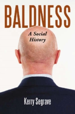 Bertrand.pt - Baldness