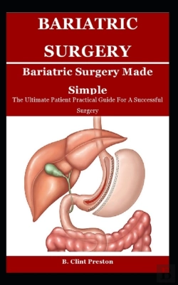 Bertrand.pt - Bariatric Sugery Made Simple