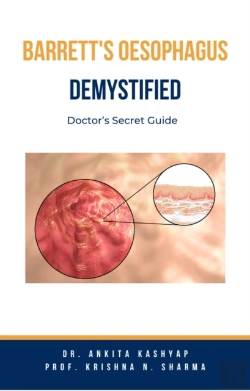 Bertrand.pt - Barretts Oesophagus Demystified: Doctor'S Secret Guide