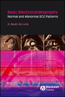 Bertrand.pt - Basic Electrocardiography