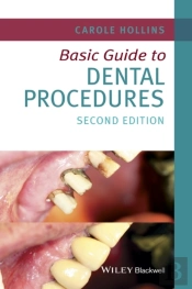 Basic Guide To Dental Procedures