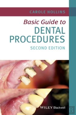 Bertrand.pt - Basic Guide To Dental Procedures