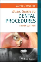 Basic Guide To Dental Procedures