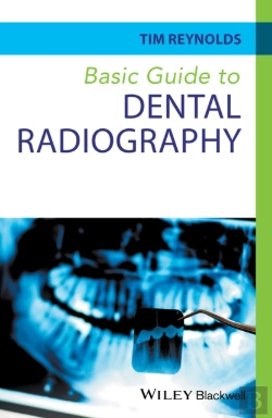 Bertrand.pt - Basic Guide To Dental Radiography