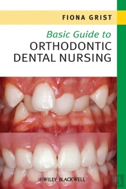 Bertrand.pt - Basic Guide To Orthodontic Dental Nursing