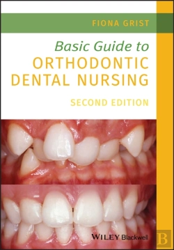 Bertrand.pt - Basic Guide To Orthodontic Dental Nursing