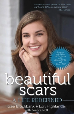 Bertrand.pt - Beautiful Scars