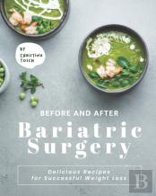 Before And After Bariatric Surgery