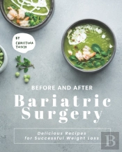 Before And After Bariatric Surgery