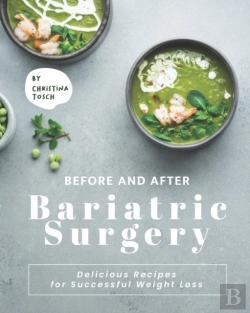 Bertrand.pt - Before And After Bariatric Surgery