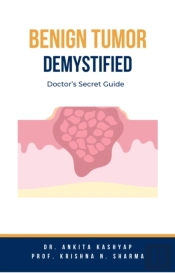 Benign Tumor Demystified: Doctor'S Secret Guide