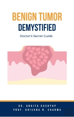 Bertrand.pt - Benign Tumor Demystified: Doctor'S Secret Guide