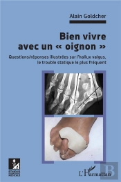 Bien Vivre Avec Un 'Oignon' : Questions/Réponses Illsutrées Sur L'Hallux Valgus, Le Trouble Statique Le Plus Fréquent