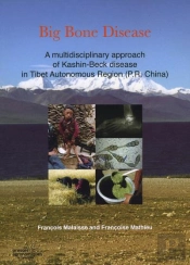 Big Bone Disease A Multidisciplinary Approach Of Kashinbeck Disease In Tibetautonomous Region P R Ch