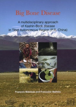 Bertrand.pt - Big Bone Disease A Multidisciplinary Approach Of Kashinbeck Disease In Tibetautonomous Region P R Ch