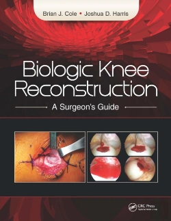 Bertrand.pt - Biologic Knee Reconstruction