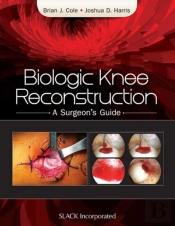 Biologic Knee Reconstruction