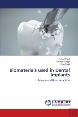 Bertrand.pt - Biomaterials Used In Dental Implants