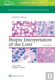 Biopsy Interpretation Of The Liver