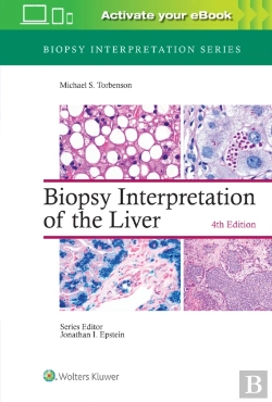 Bertrand.pt - Biopsy Interpretation Of The Liver