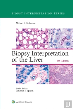 Bertrand.pt - Biopsy Interpretation Of The Liver