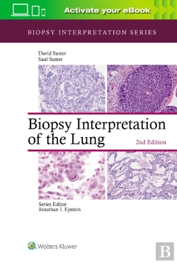 Bertrand.pt - Biopsy Interpretation Of The Lung