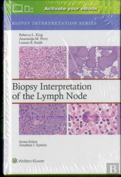 Bertrand.pt - Biopsy Interpretation Of The Lymph Node: Print + Ebook With Multimedia