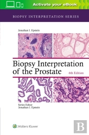 Biopsy Interpretation Of The Prostate