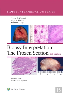 Bertrand.pt - Biopsy Interpretation: The Frozen Section